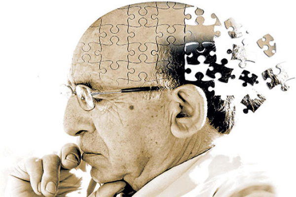 10 dấu hiệu sớm cảnh báo bệnh Alzheimer